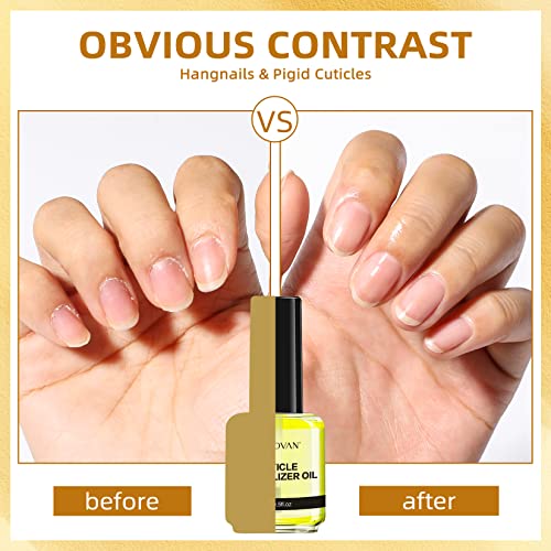 Óleo de cutícula de Morovan, 15 ml de unhas naturais unhas unhas e cutículas Cuidado - para reparo, hidratar e fortalecer para cutículas danificadas, calmante e nutrir