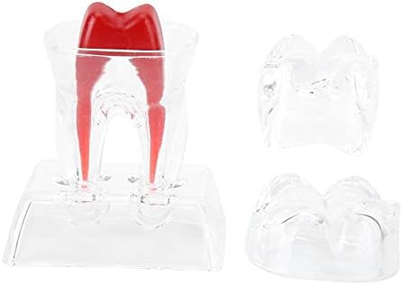 Ottjakin aprimora sua educação odontológica com modelos de dentes de plástico separáveis ​​- Estudo endodôntico completo