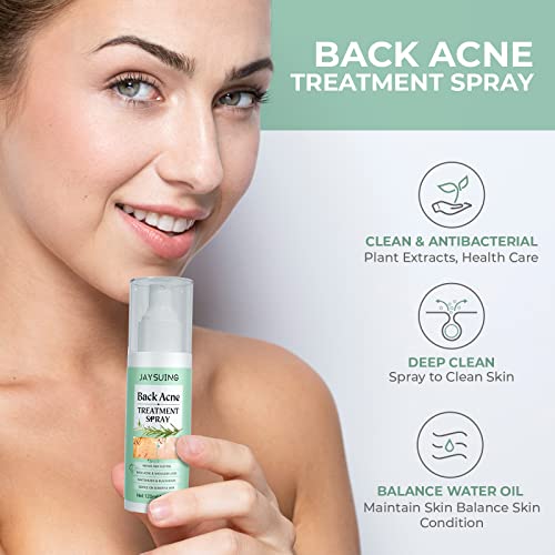 Tratamento de acne nas costas, spray de acne nas costas, 2% de spray de ácido salicílico, tratamento de acne corporal com fórmula