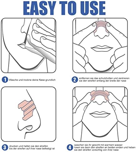RitoEasysports 100pcs Faixa nasal, redução de ronco impedir a respiração da boca promove os remendos do nariz do sono