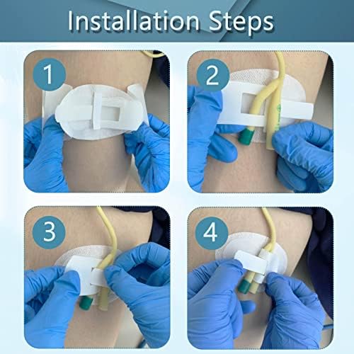 Adesivos de fixação da banda de banda de banda de catéter - suporte de estabilização de drenagem de coletor adesivo de suporte urinário para incontinência para incontinência