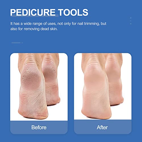Excelt Cutticle Remover Manicure Pedicure Tool Clipper- Aço inoxidável Cutícula de cutícula Cuttilha doméstica Clipper Ferramenta